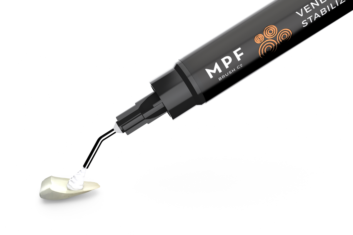 Impiallacciatura MPF e pasta stabilizzante per corone